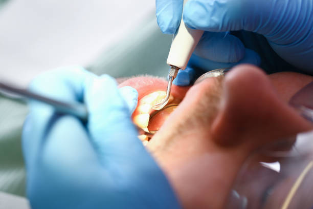 Best Pediatric Emergency Dentist in Lomita, CA