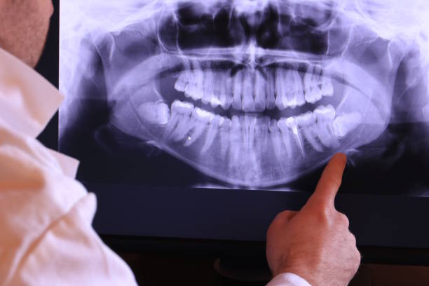 Best Emergency Broken Tooth Repair in Lomita, CA